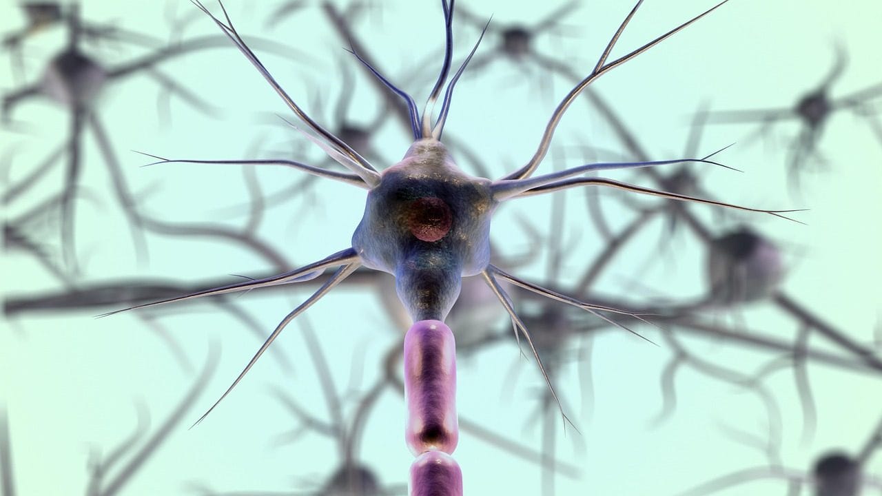 Fettbeladene Immunzellen treiben Multiple Sklerose voran