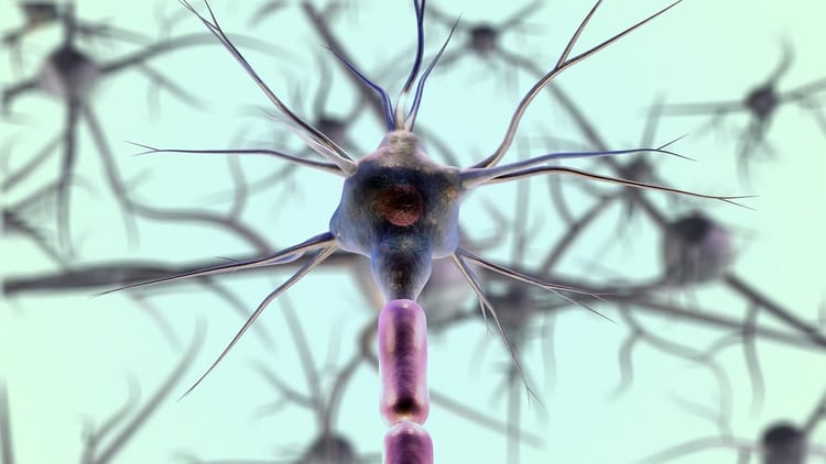 Fettbeladene Immunzellen treiben Multiple Sklerose voran